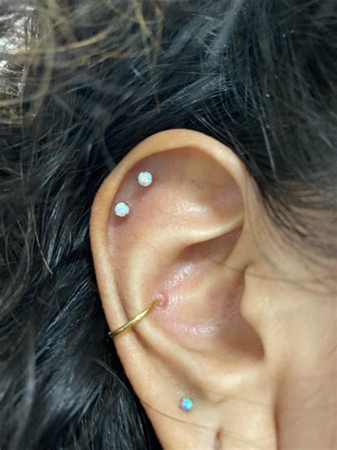 bump on conch piercing|conch piercing healing timeline.